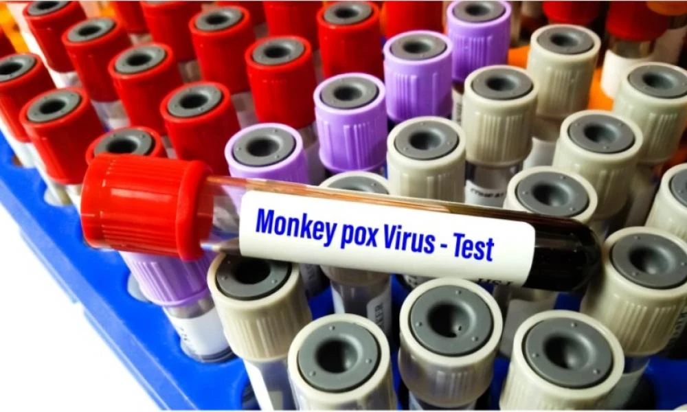 ΗΠΑ: Πάνω από χίλια κρούσματα ευλογιάς των πιθήκων έχουν επιβεβαιωθεί